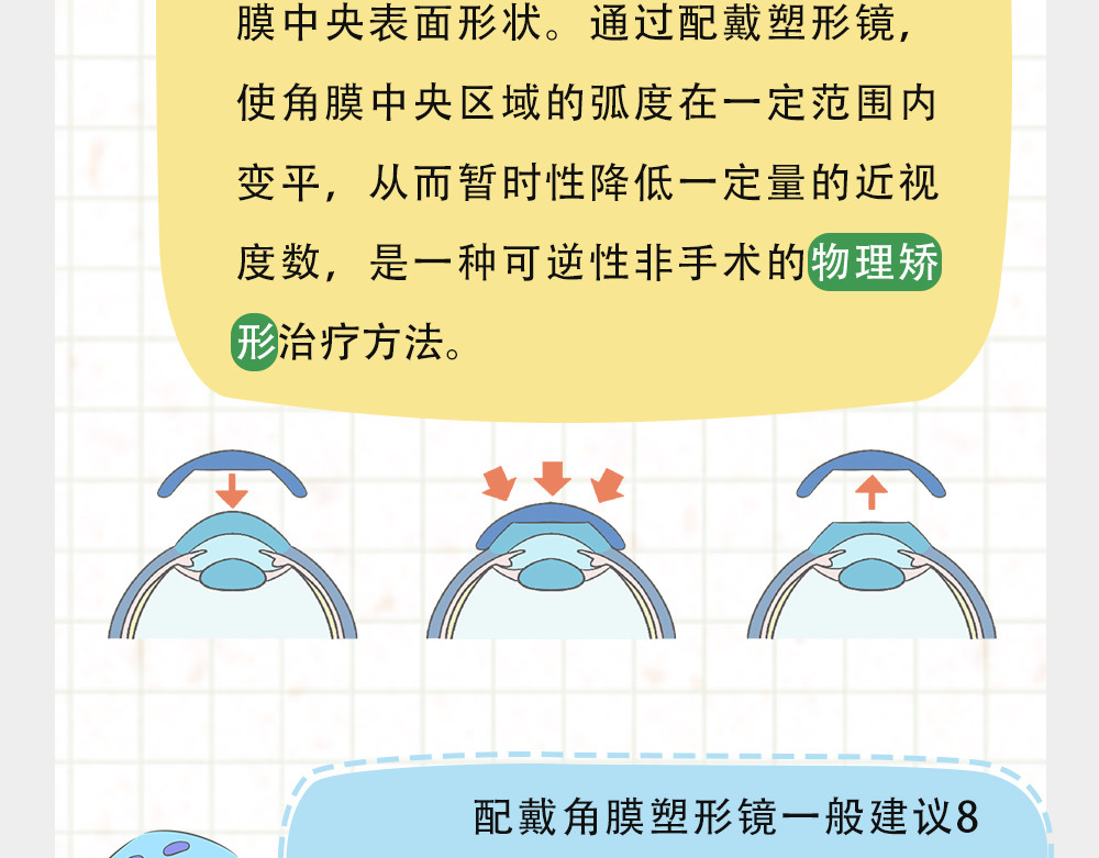 漫话隐形眼镜 戴框架眼镜的烦恼（下） 第31页