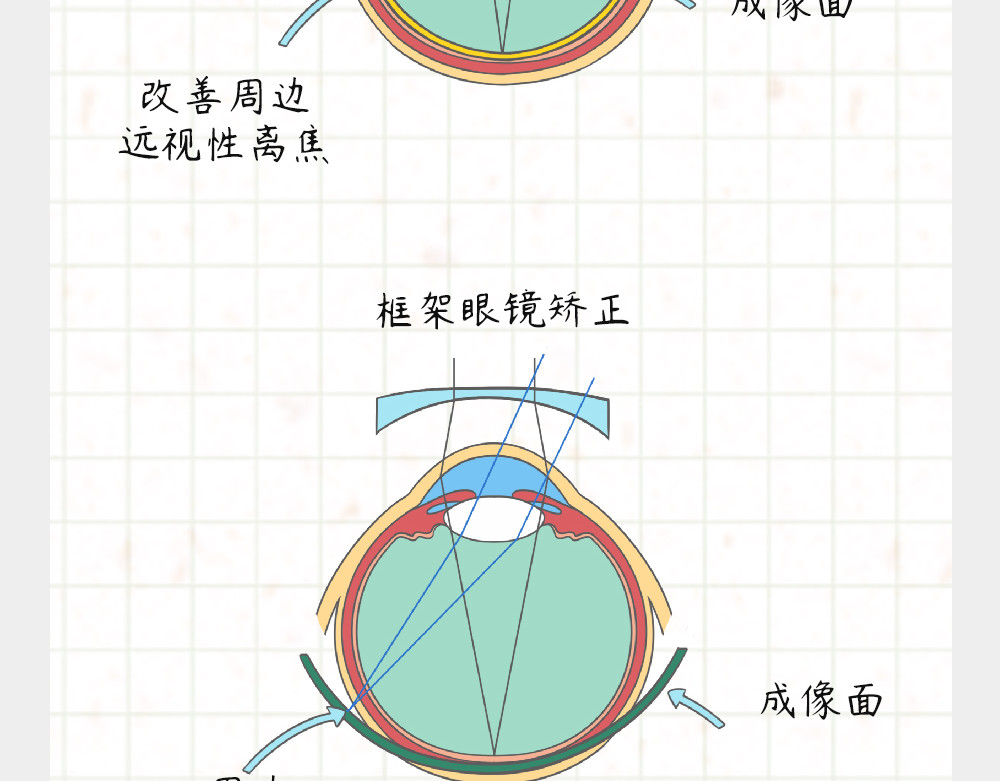 漫话隐形眼镜 戴框架眼镜的烦恼（下） 第34页