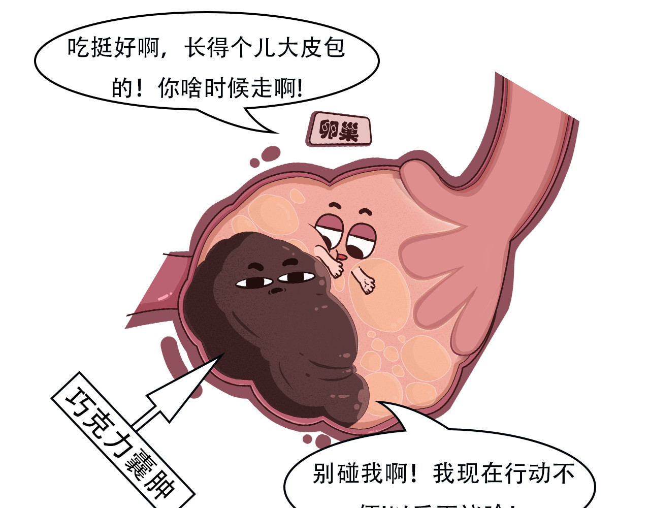 达神宇宙—你不知道的小知识 巧克力？囊肿？这俩也能在一起？ 第11页