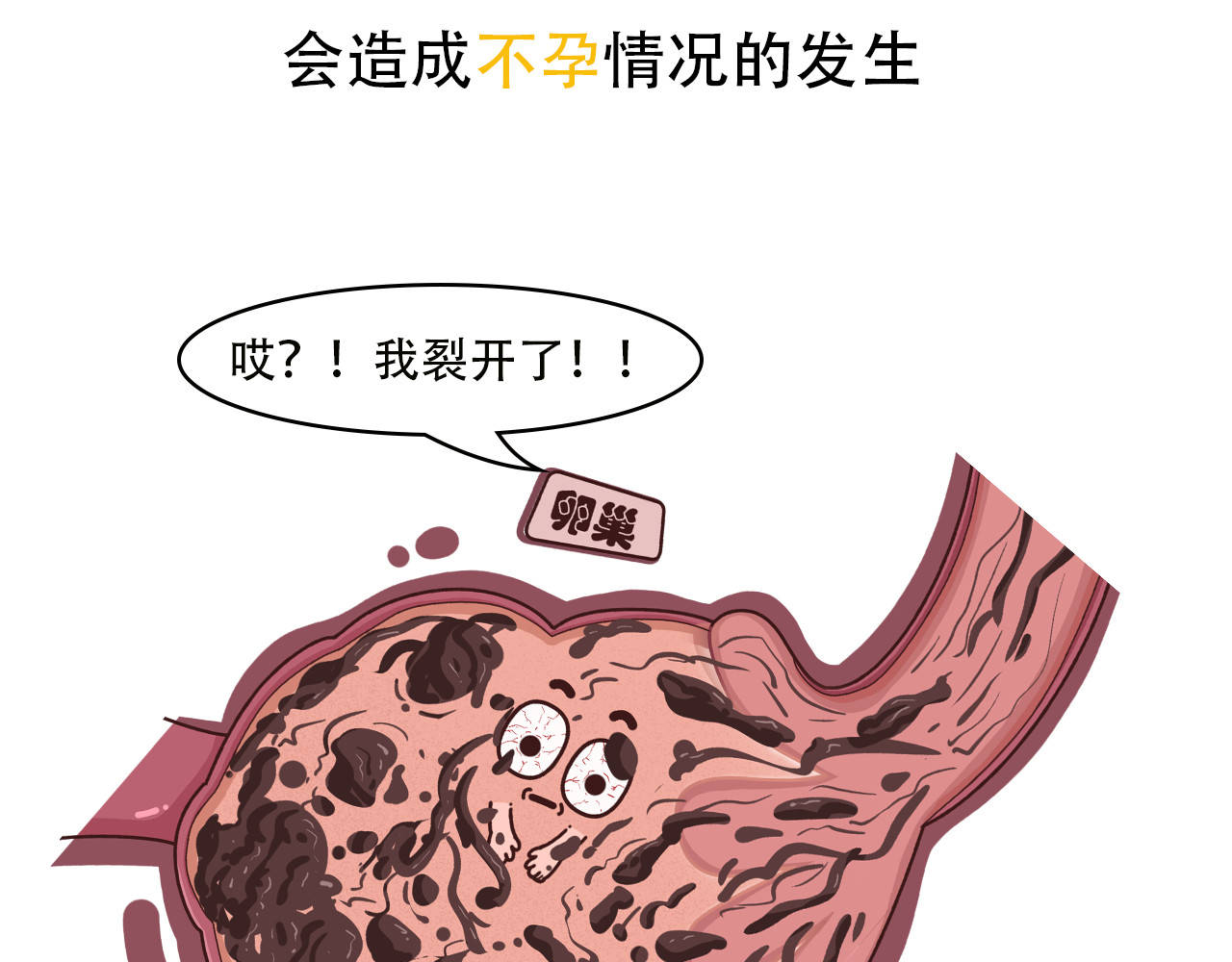 达神宇宙—你不知道的小知识 巧克力？囊肿？这俩也能在一起？ 第15页