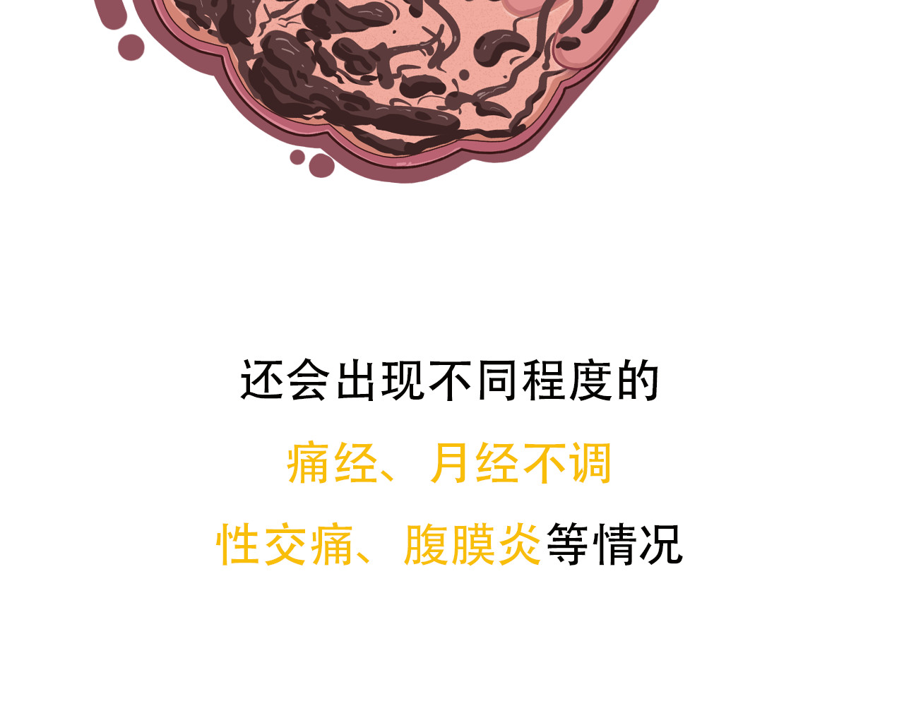 达神宇宙—你不知道的小知识 巧克力？囊肿？这俩也能在一起？ 第16页