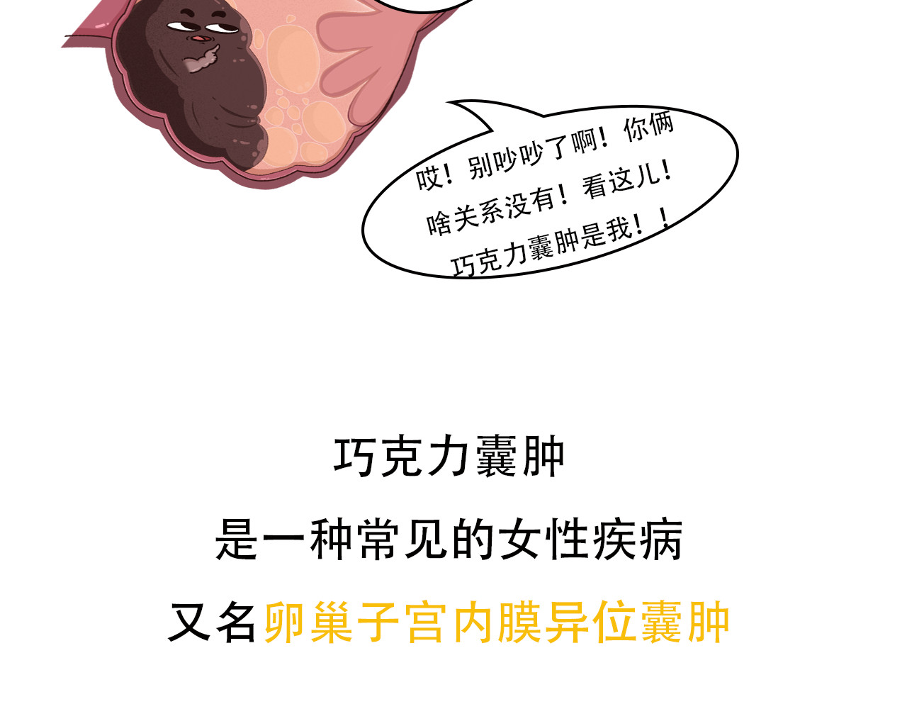 达神宇宙—你不知道的小知识 巧克力？囊肿？这俩也能在一起？ 第3页